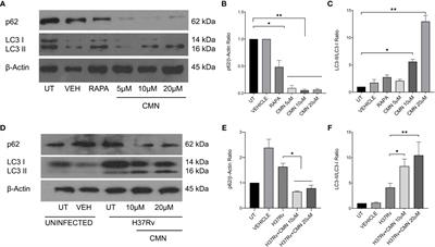 Macrophage targeted polymeric curcumin nanoparticles limit intracellular survival of Mycobacterium tuberculosis through induction of autophagy and augment anti-TB activity of isoniazid in <mark class="highlighted">RAW 264.7 macrophages</mark>